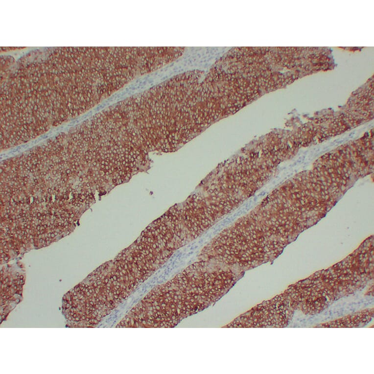 Immunohistochemistry - Anti-Cytokeratin 13 Antibody (V0045) - Antibodies.com