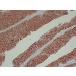 Immunohistochemistry - Anti-Cytokeratin 13 Antibody (V0045) - Antibodies.com