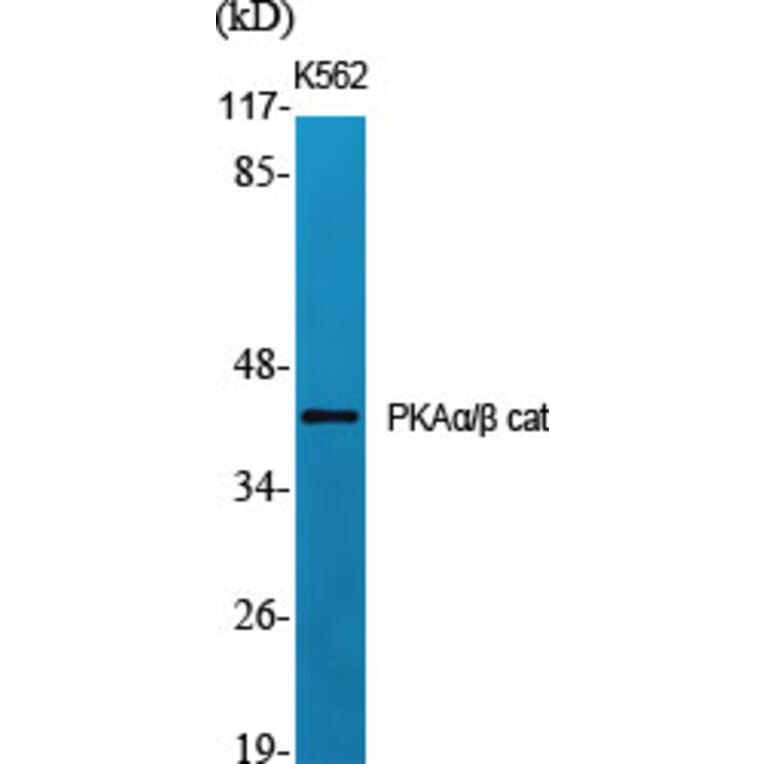 Western Blot - Anti-KAPC A + B Antibody (C10410) - Antibodies.com