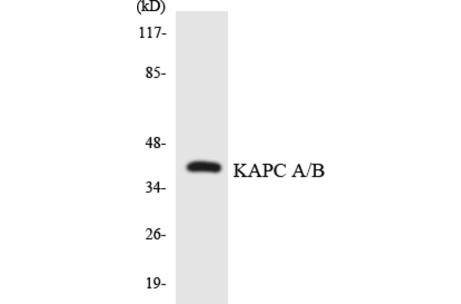 Western Blot - Anti-KAPC A + B Antibody (R12-2943) - Antibodies.com