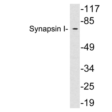 Western Blot - Anti-Synapsin I Antibody (R12-2370) - Antibodies.com
