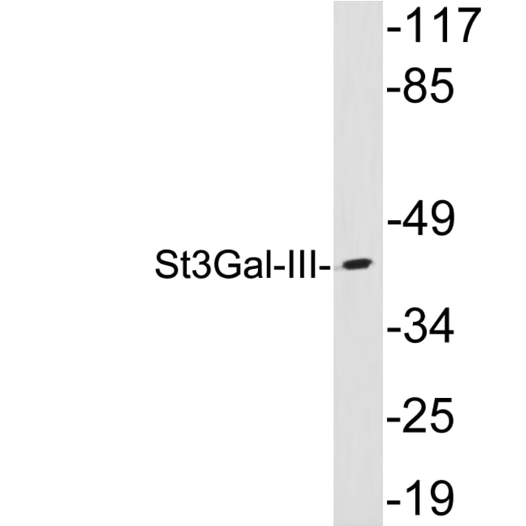 Western Blot - Anti-St3Gal-III Antibody (R12-2368) - Antibodies.com