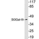 Western Blot - Anti-St3Gal-III Antibody (R12-2368) - Antibodies.com