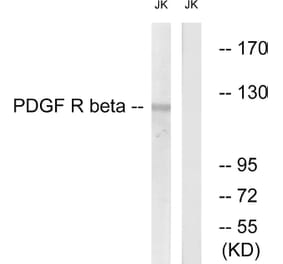 Western Blot - Anti-PDGFR beta Antibody (B0970) - Antibodies.com