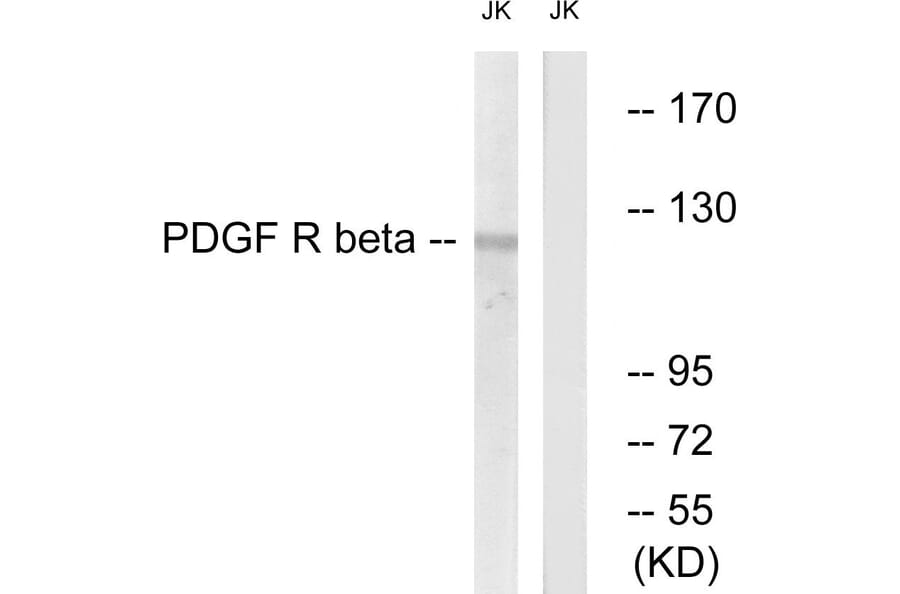 Western Blot - Anti-PDGFR beta Antibody (B0970) - Antibodies.com