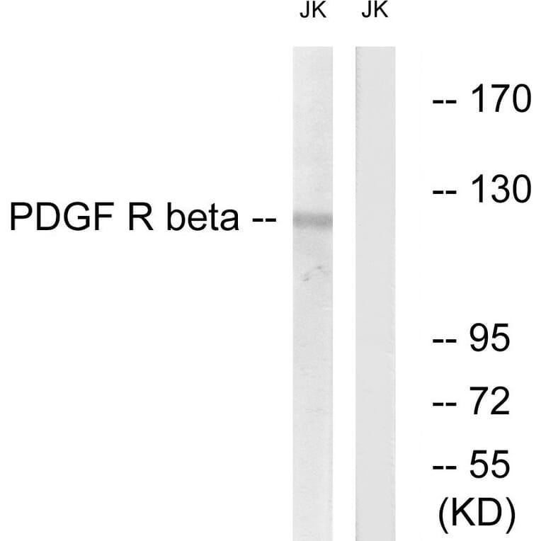 Western Blot - Anti-PDGFR beta Antibody (B0970) - Antibodies.com