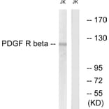 Western Blot - Anti-PDGFR beta Antibody (B0970) - Antibodies.com