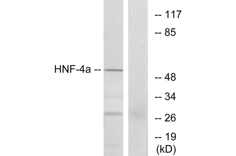 Western Blot - Anti-HNF4 alpha Antibody (B7108) - Antibodies.com
