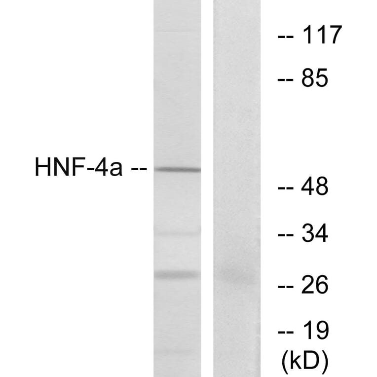 Western Blot - Anti-HNF4 alpha Antibody (B7108) - Antibodies.com