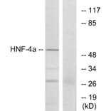 Western Blot - Anti-HNF4 alpha Antibody (B7108) - Antibodies.com