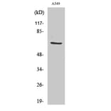 Western Blot - Anti-GCSc-gamma Antibody (R12-2156) - Antibodies.com