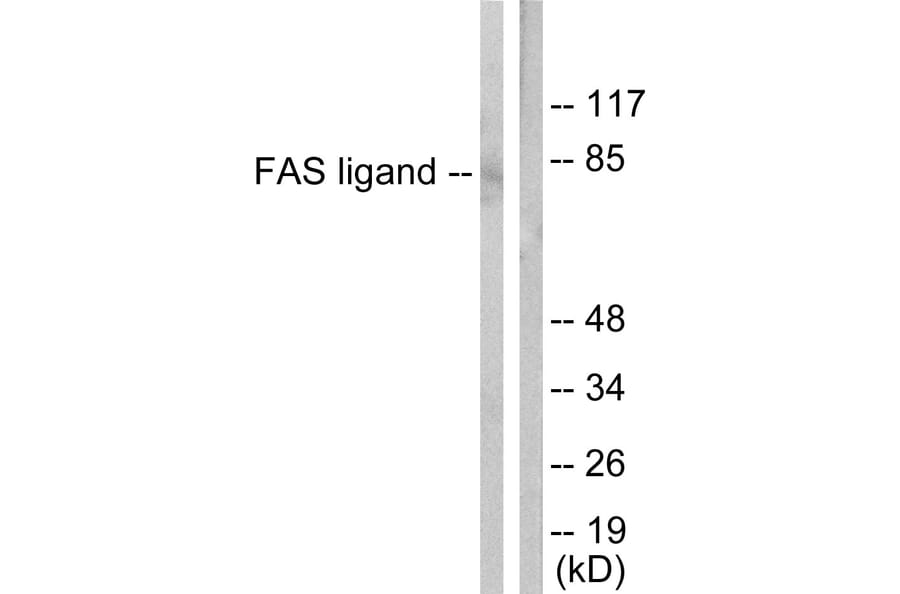 Western Blot - Anti-FAS ligand Antibody (C0189) - Antibodies.com