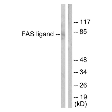 Western Blot - Anti-FAS ligand Antibody (C0189) - Antibodies.com