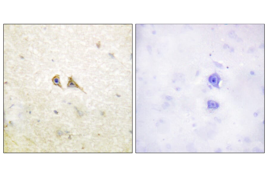 Immunohistochemistry - Anti-FAS ligand Antibody (C0189) - Antibodies.com