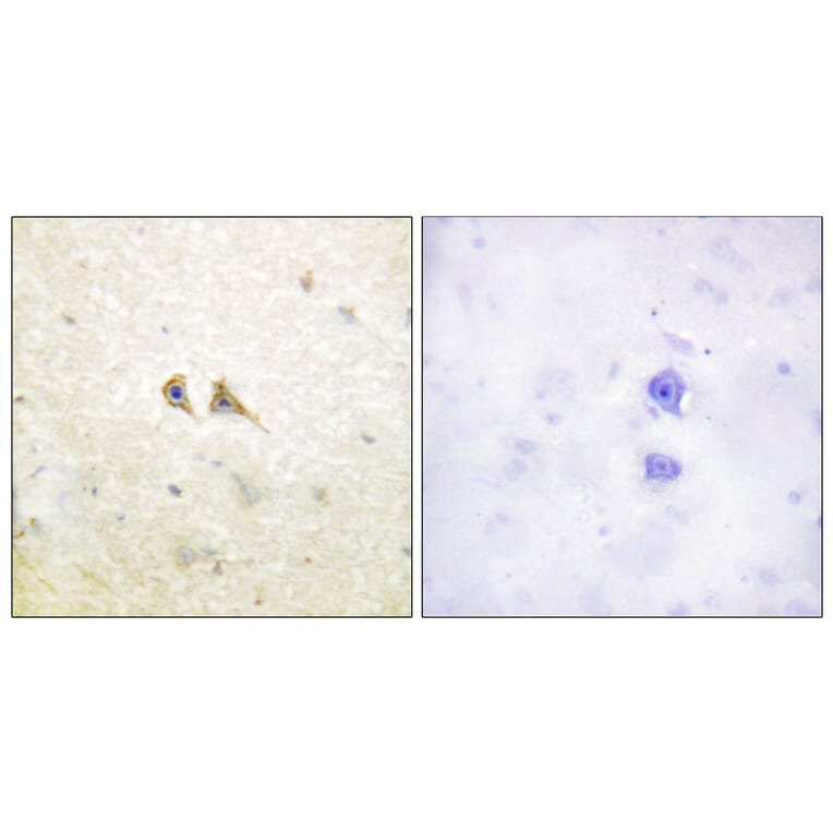 Immunohistochemistry - Anti-FAS ligand Antibody (C0189) - Antibodies.com