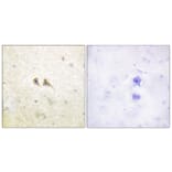 Immunohistochemistry - Anti-FAS ligand Antibody (C0189) - Antibodies.com