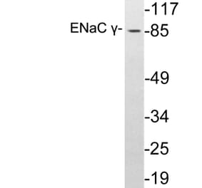 Western Blot - Anti-ENaC gamma Antibody (R12-2131) - Antibodies.com
