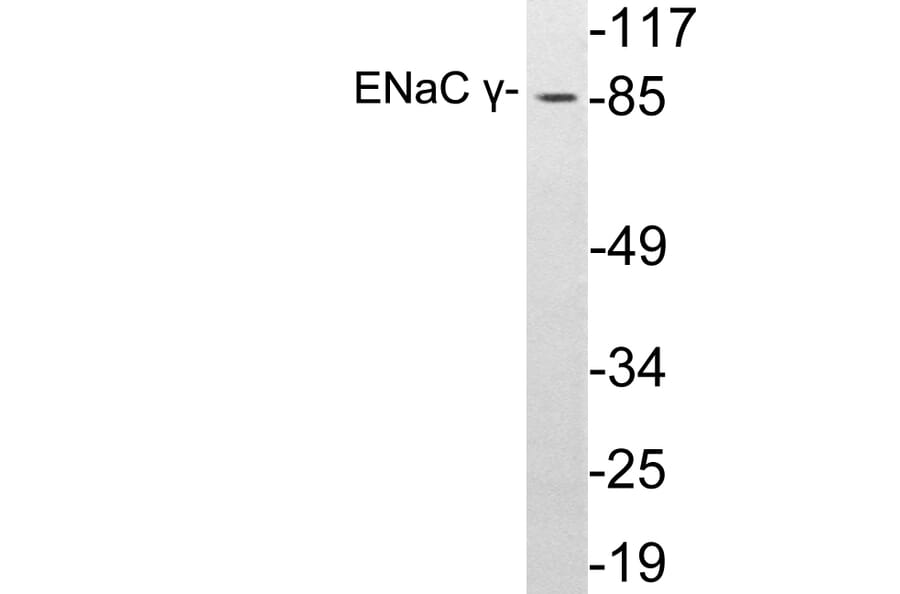 Western Blot - Anti-ENaC gamma Antibody (R12-2131) - Antibodies.com