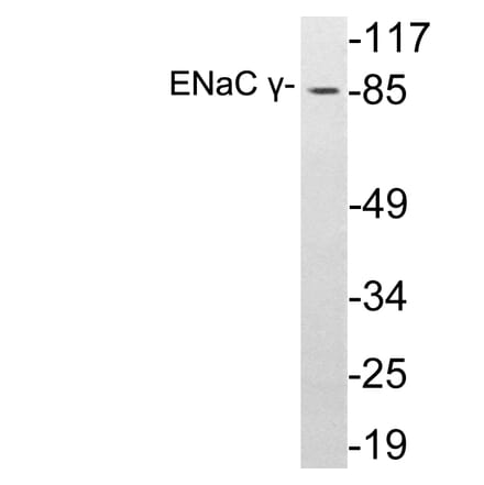 Western Blot - Anti-ENaC gamma Antibody (R12-2131) - Antibodies.com