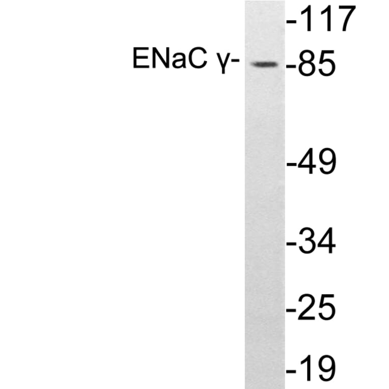 Western Blot - Anti-ENaC gamma Antibody (R12-2131) - Antibodies.com