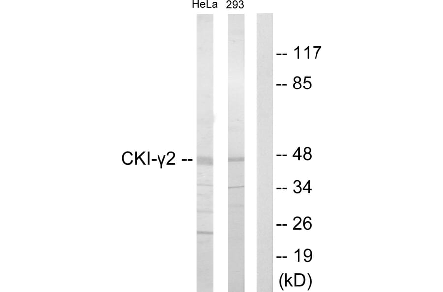 Western Blot - Anti-CKI-gamma2 Antibody (C10793) - Antibodies.com
