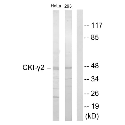 Western Blot - Anti-CKI-gamma2 Antibody (C10793) - Antibodies.com