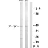 Western Blot - Anti-CKI-gamma2 Antibody (C10793) - Antibodies.com