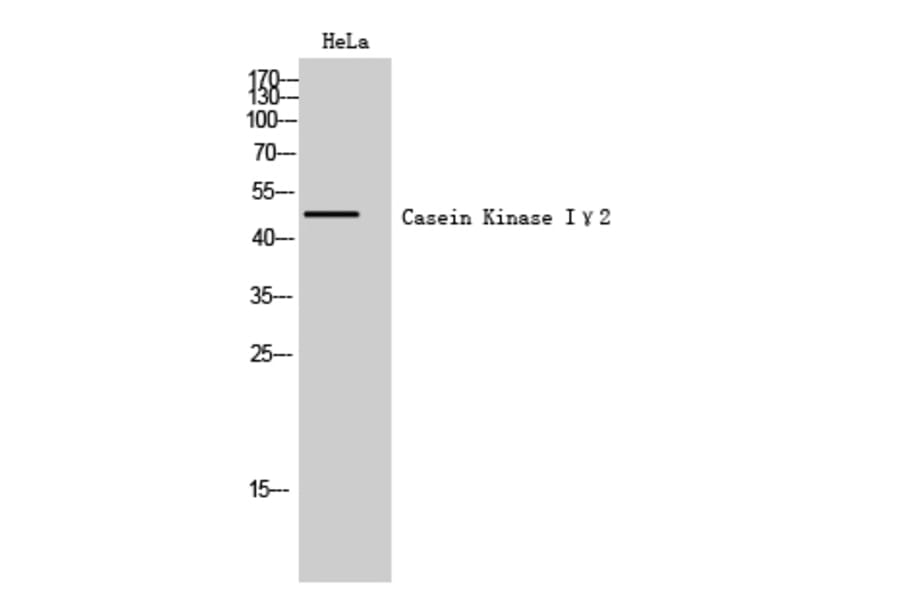 Western Blot - Anti-CKI-gamma2 Antibody (C10793) - Antibodies.com
