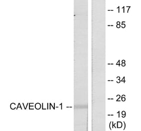 Western Blot - Anti-Caveolin-1 Antibody (B7034) - Antibodies.com