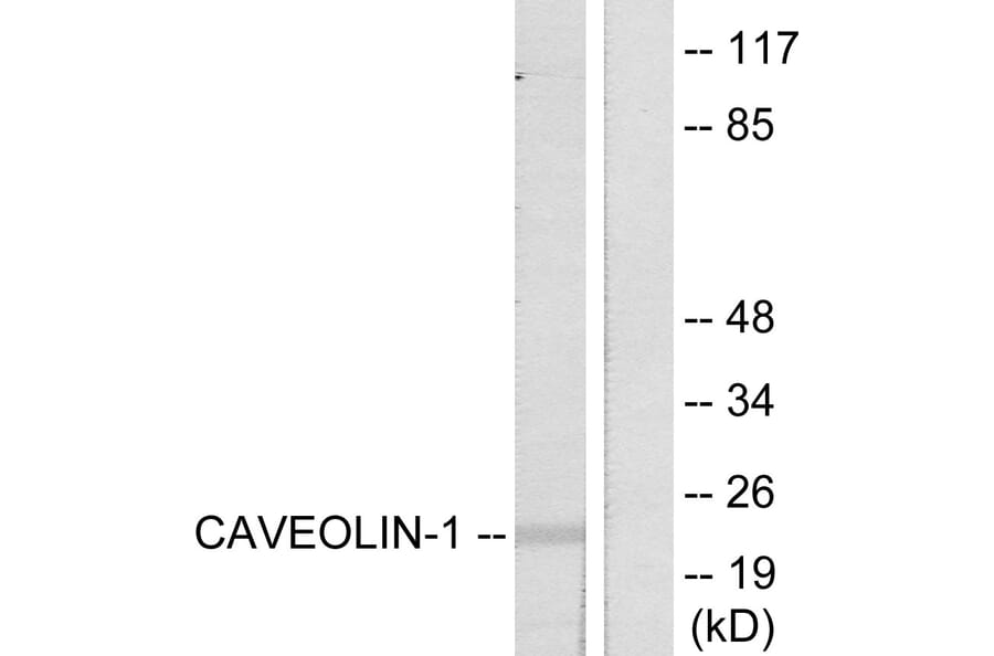 Western Blot - Anti-Caveolin-1 Antibody (B7034) - Antibodies.com