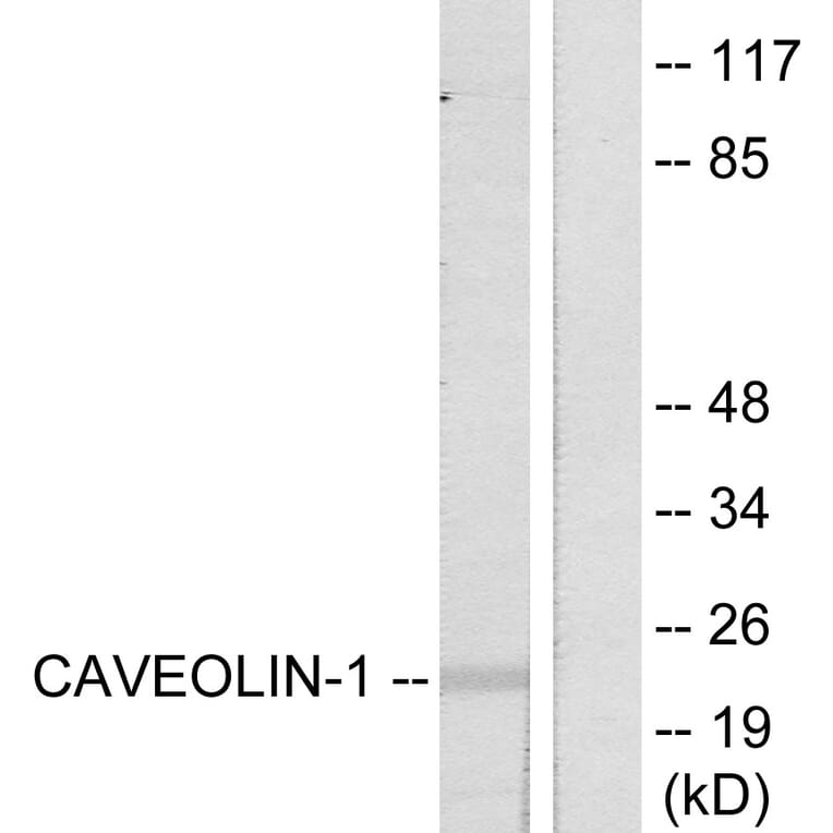 Western Blot - Anti-Caveolin-1 Antibody (B7034) - Antibodies.com