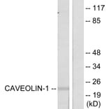 Western Blot - Anti-Caveolin-1 Antibody (B7034) - Antibodies.com