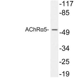Western Blot - Anti-AChRalpha5 Antibody (R12-2009) - Antibodies.com