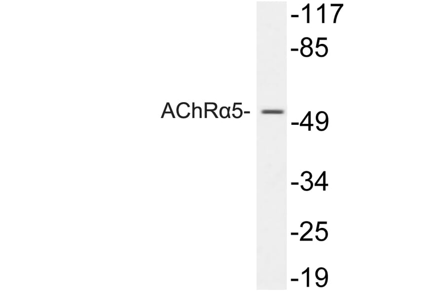 Western Blot - Anti-AChRalpha5 Antibody (R12-2009) - Antibodies.com