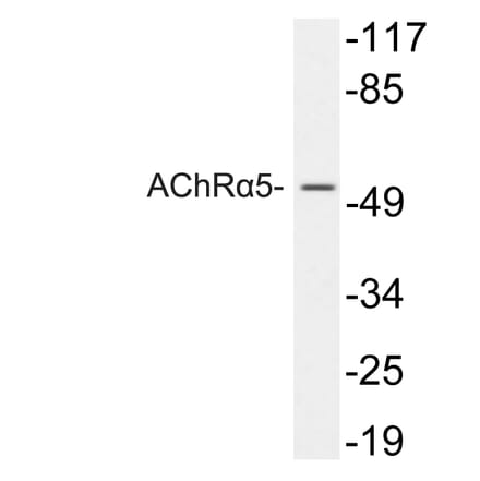 Western Blot - Anti-AChRalpha5 Antibody (R12-2009) - Antibodies.com