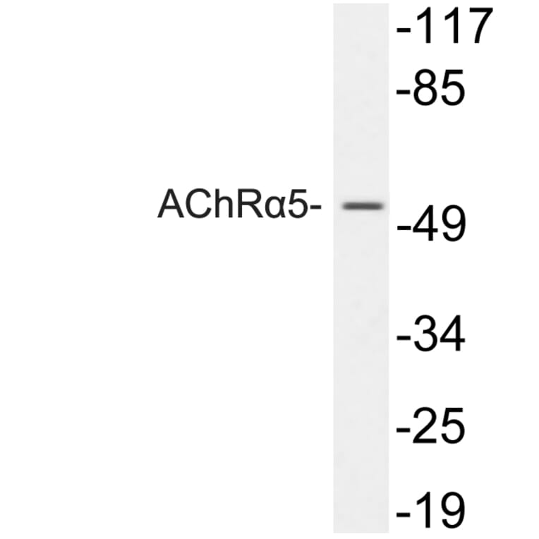 Western Blot - Anti-AChRalpha5 Antibody (R12-2009) - Antibodies.com