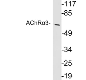 Western Blot - Anti-AChRalpha3 Antibody (R12-2008) - Antibodies.com