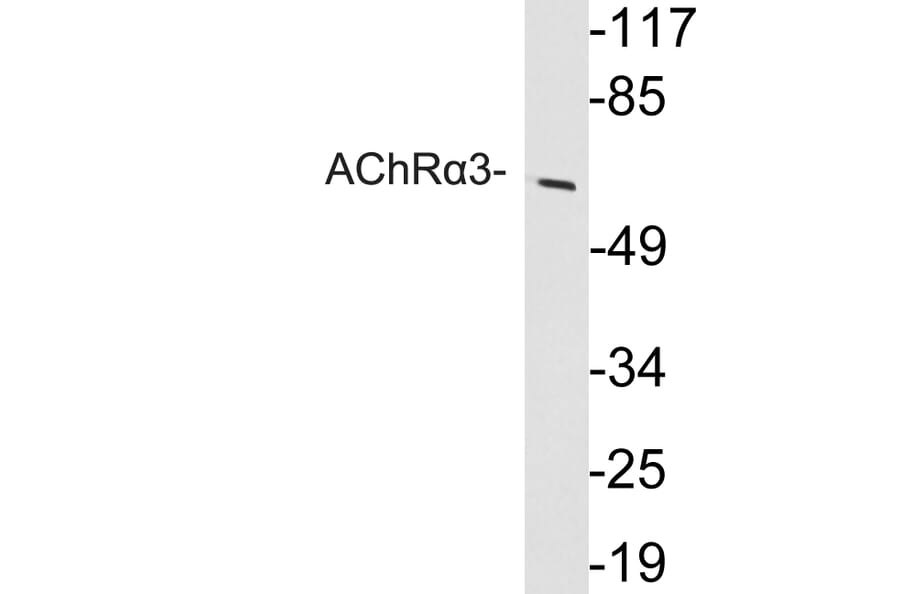 Western Blot - Anti-AChRalpha3 Antibody (R12-2008) - Antibodies.com