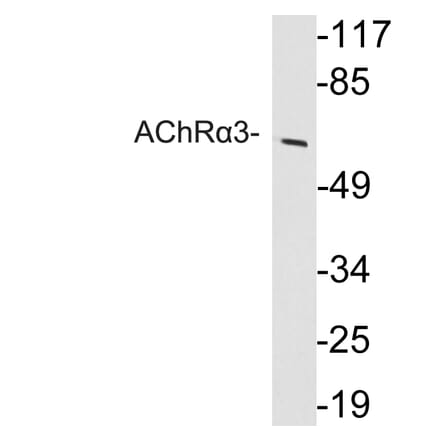 Western Blot - Anti-AChRalpha3 Antibody (R12-2008) - Antibodies.com