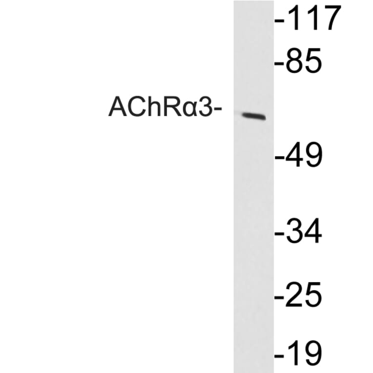 Western Blot - Anti-AChRalpha3 Antibody (R12-2008) - Antibodies.com