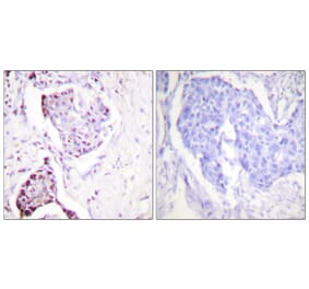 Immunohistochemistry - Anti-Ubiquitin Antibody (C0385) - Antibodies.com