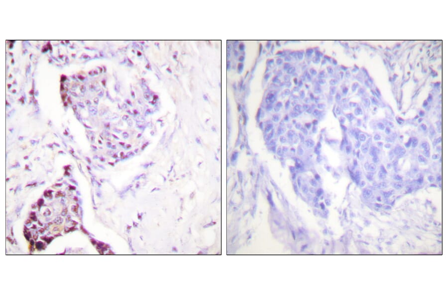 Immunohistochemistry - Anti-Ubiquitin Antibody (C0385) - Antibodies.com