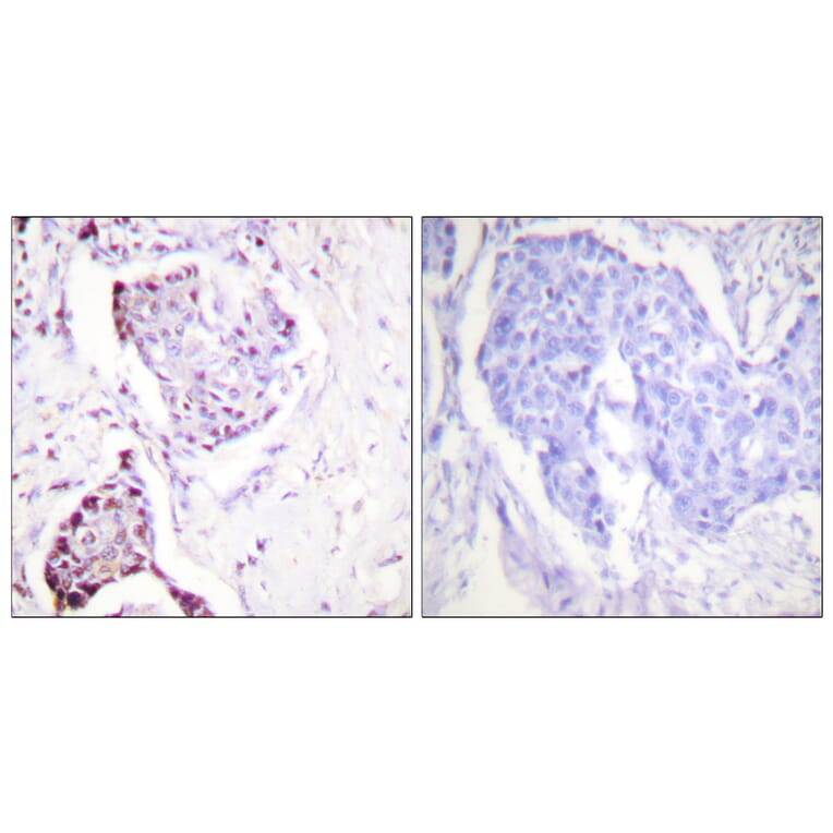 Immunohistochemistry - Anti-Ubiquitin Antibody (C0385) - Antibodies.com