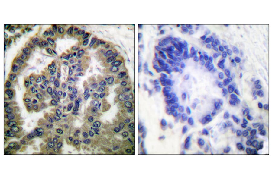 Immunohistochemistry - Anti-TGF beta2 Antibody (C0341) - Antibodies.com