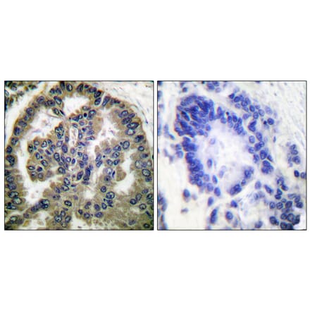 Immunohistochemistry - Anti-TGF beta2 Antibody (C0341) - Antibodies.com