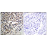 Immunohistochemistry - Anti-PLC beta3 Antibody (B0722) - Antibodies.com