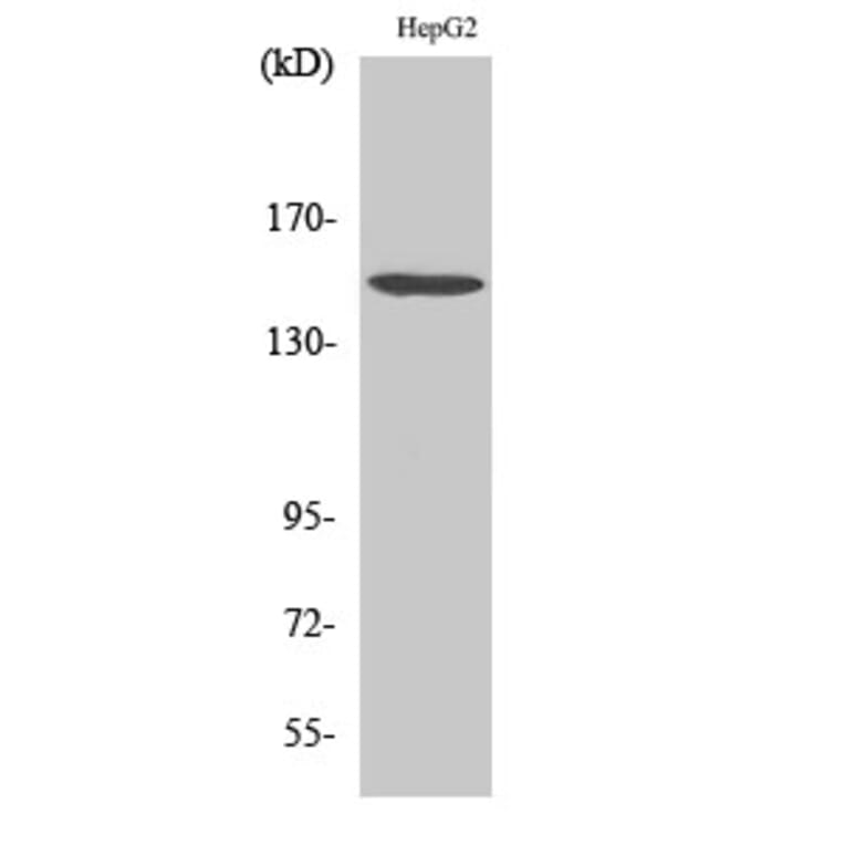 Western Blot - Anti-PLC beta3 Antibody (B0722) - Antibodies.com