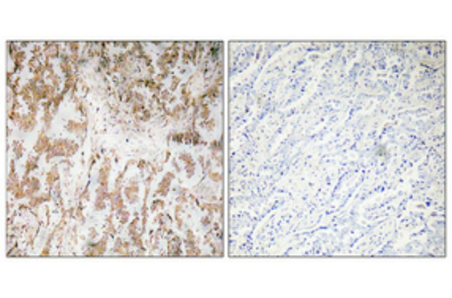 Immunohistochemistry - Anti-IL-1alpha Antibody (R12-2203) - Antibodies.com