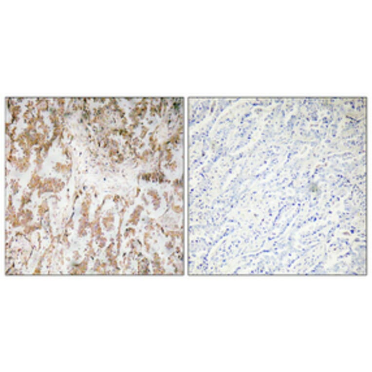 Immunohistochemistry - Anti-IL-1alpha Antibody (R12-2203) - Antibodies.com