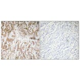 Immunohistochemistry - Anti-IL-1alpha Antibody (R12-2203) - Antibodies.com